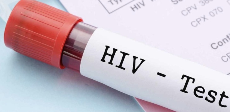 HIV/AIDS test kit. PHOTO/Courtesy