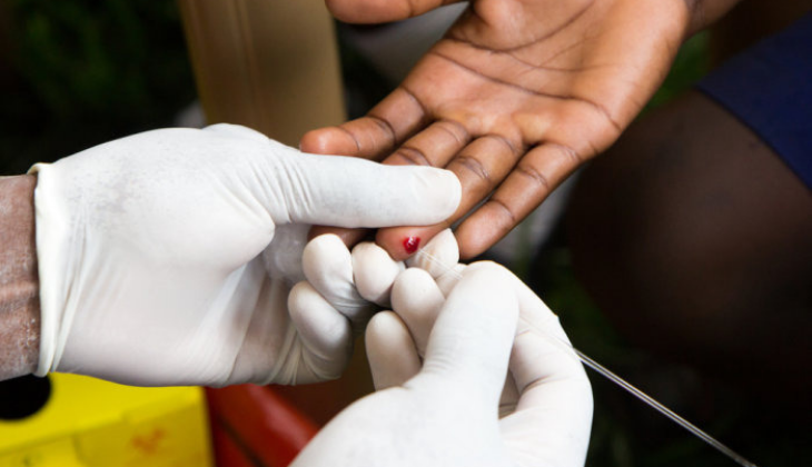 HIV test