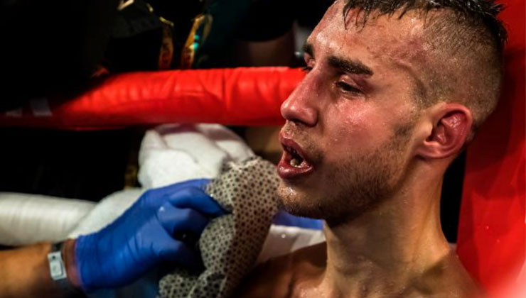 Boxer dies after sustaining injuries during fight
