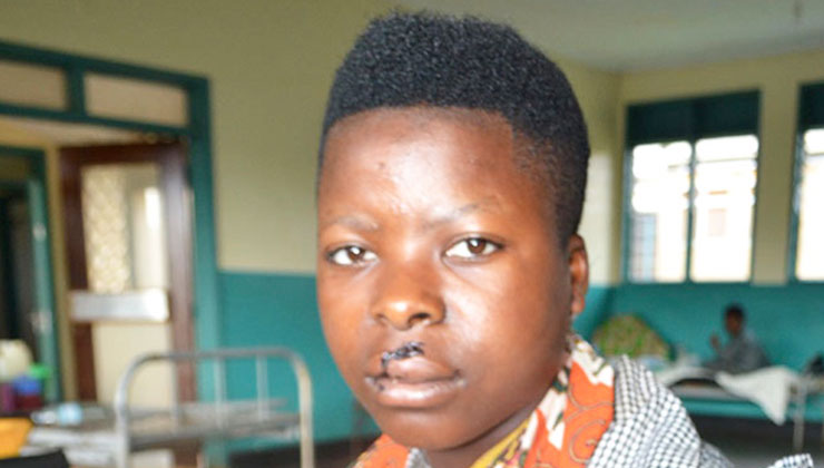 An 18-year-old woman from Kagadi is recuperating in hospital after she was attacked by her husband for criticising his sexual prowess. [PHOTO | COURTESY OF NEW VISION]