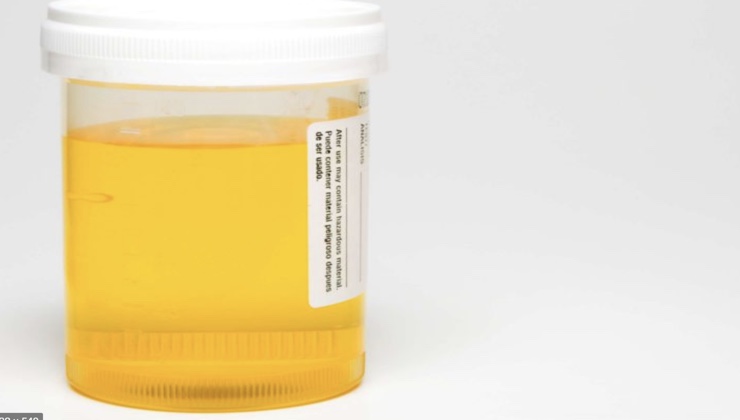 Tanzania investigates company ‘buying pregnant women’s urine’