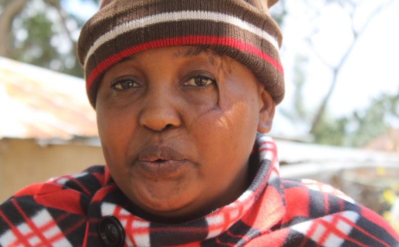 Woman recalls how her ex-husband chopped off her hands, threw them to the dogs as she watched
