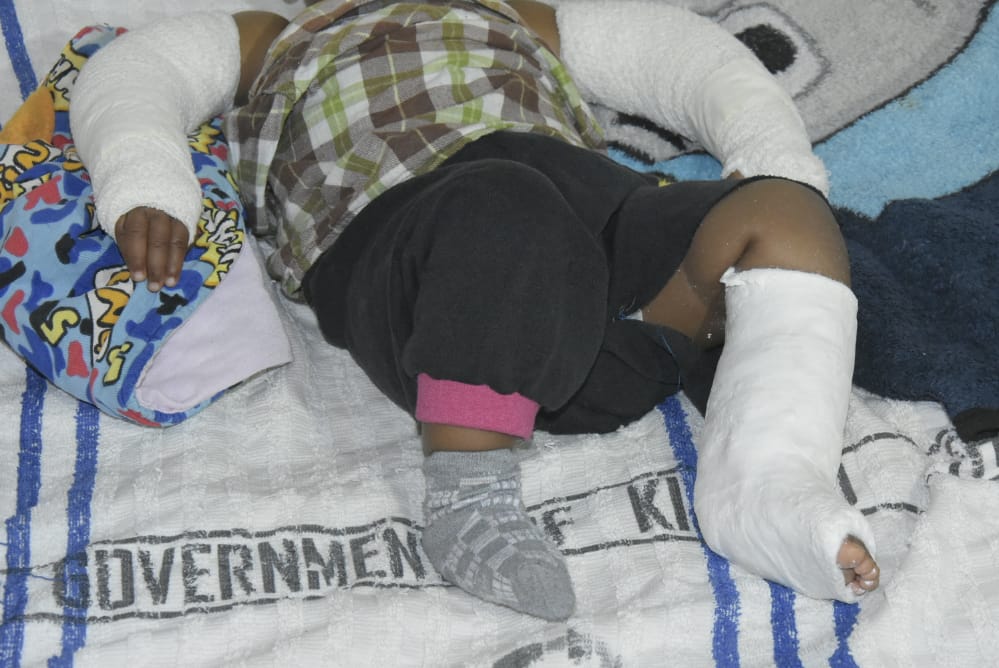8-month-old baby assaulted by stepfather out of danger as 18-year-old mother is held in custody
