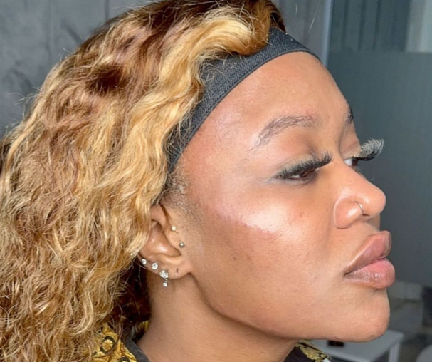 Socialite Vera Sidika unveils face after a cosmetic procedure. PHOTO/@queenveebosset/Instagram