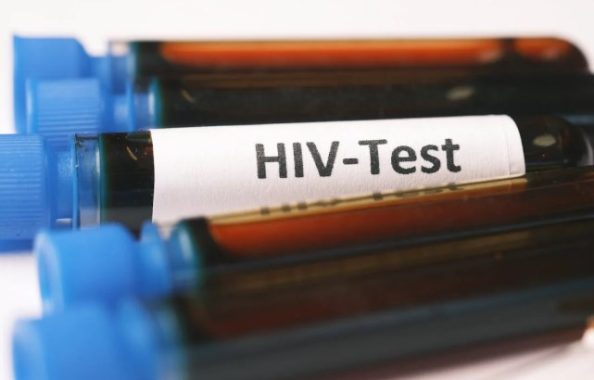 Blood Samples for HIV Test. Image used for representation purposes in this article. PHOTO/Pexels
