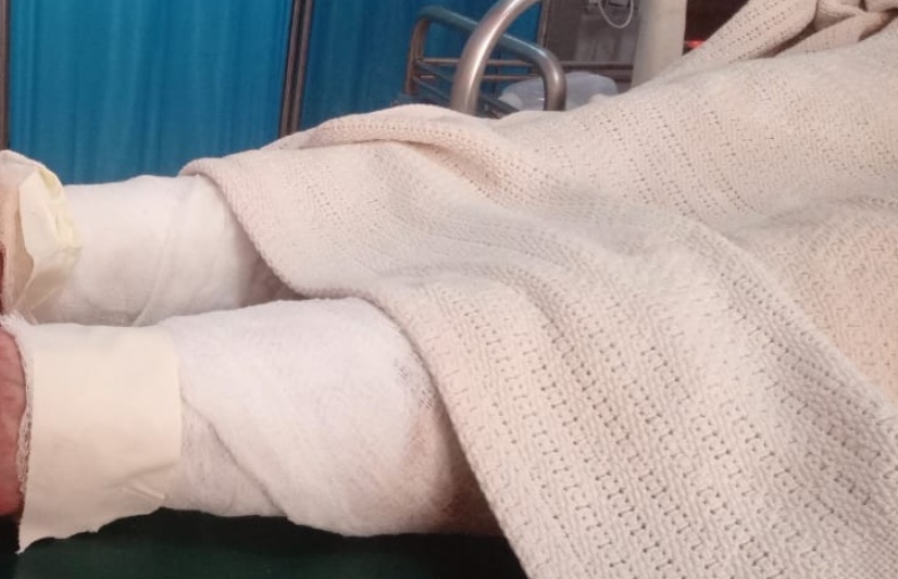 Makueni: 29-year-old woman sets herself on fire after domestic dispute