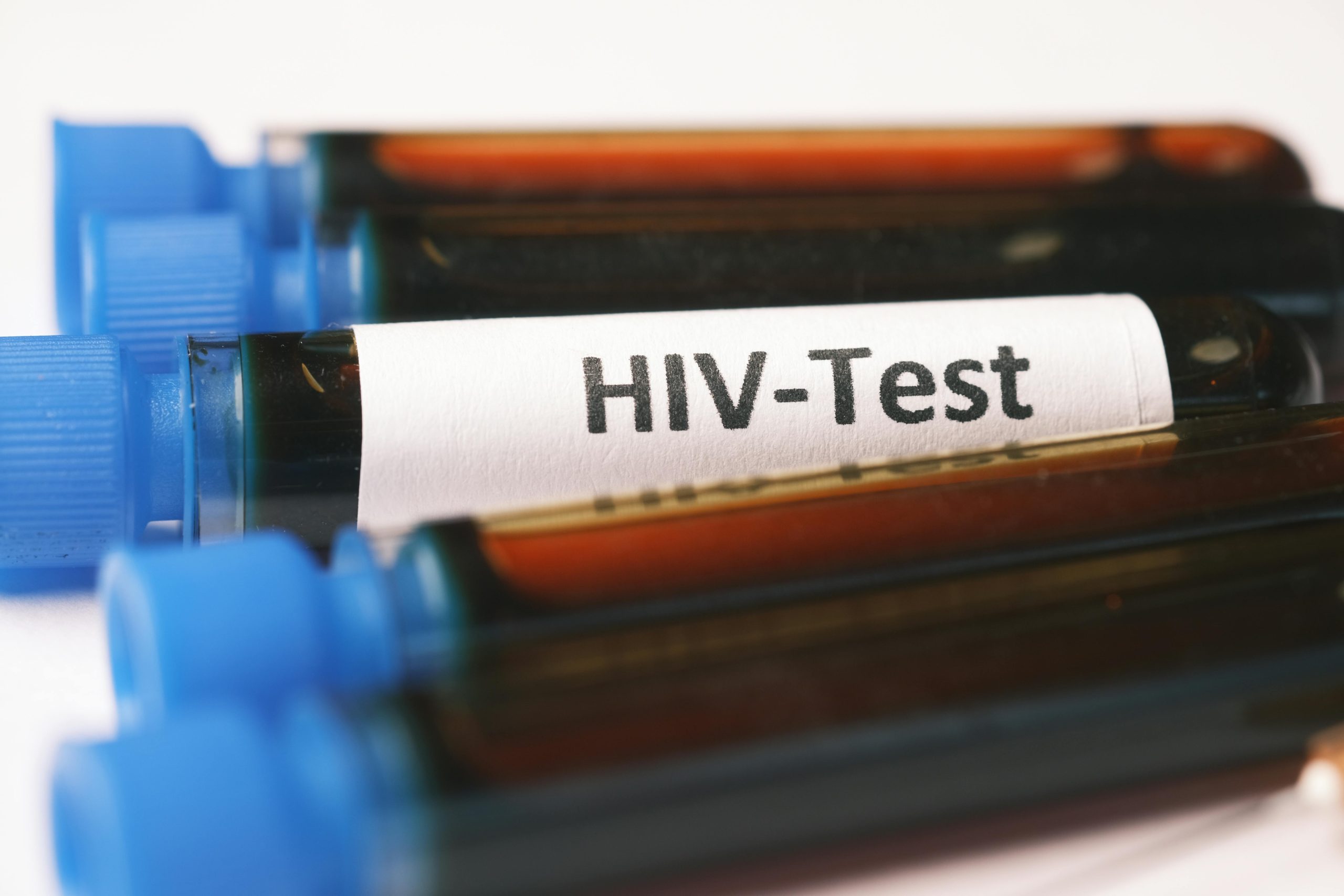 Kenya vows to keep HIV services running, but counties struggle to foot bills – Report