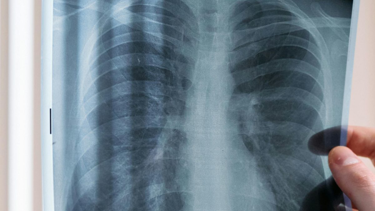 A simple test to check how old your lungs are