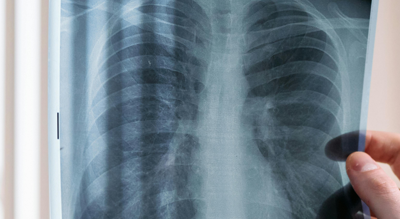A simple test to check how old your lungs are