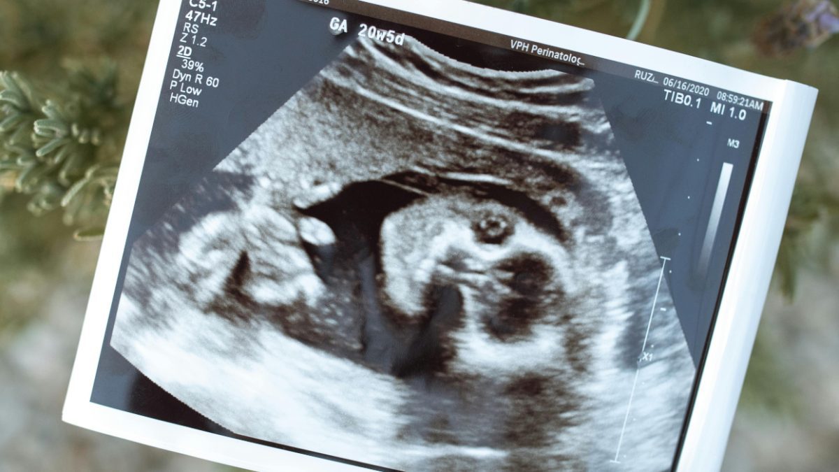 Lab-grown human embryo model produces blood cells