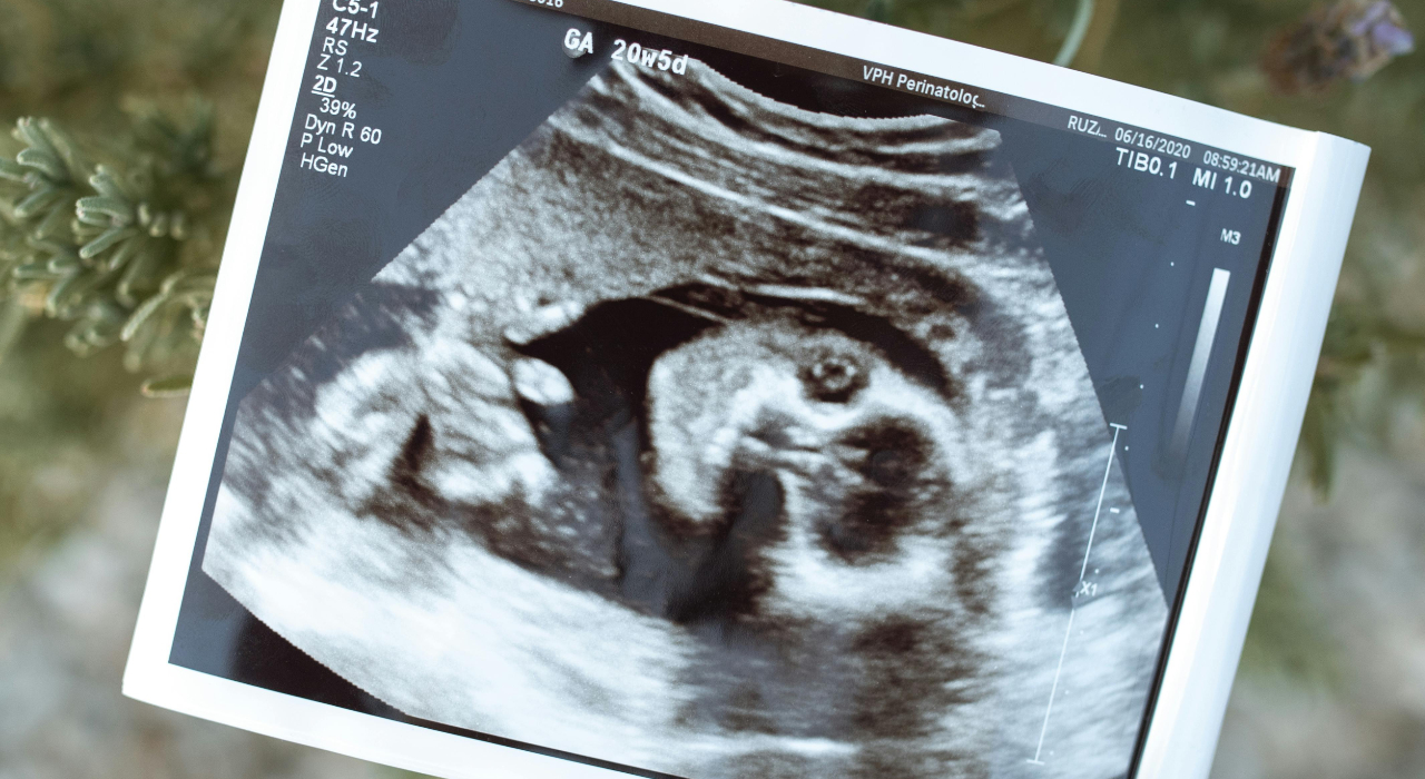 Lab-grown human embryo model produces blood cells