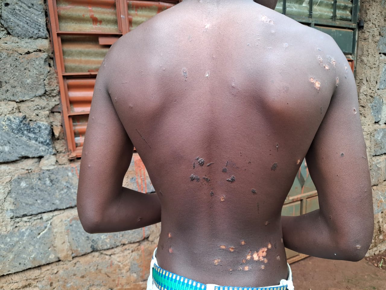 Gatundu North: Family cries for justice after teen is brutally tortured