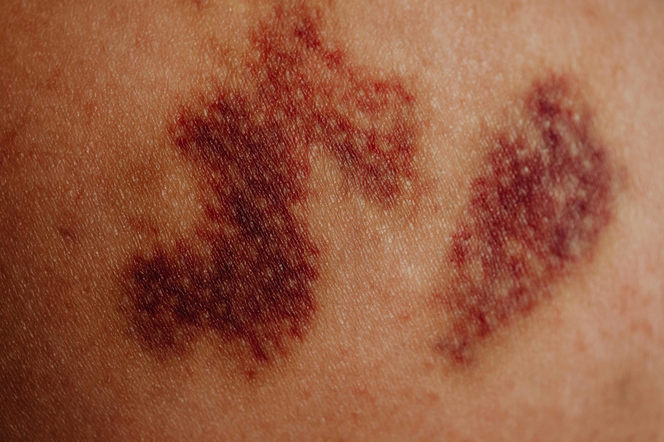Why are women being forced to go abroad to help heal from a lifetime of trauma?
