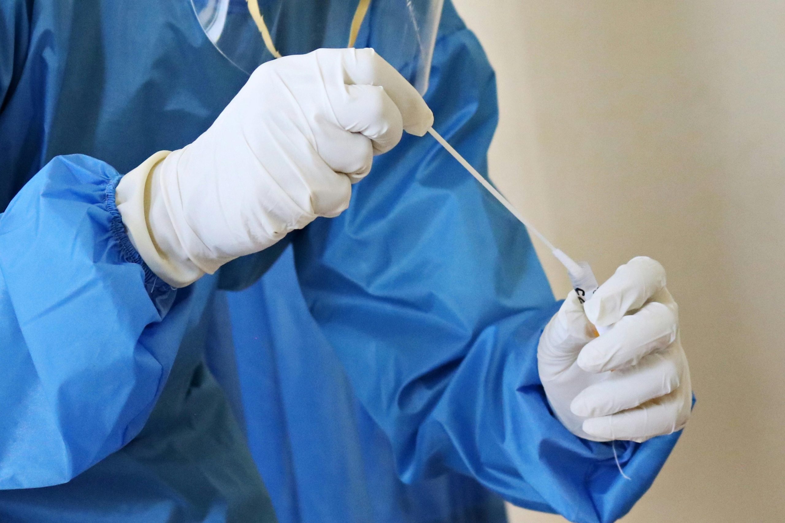 Ugandan men rush for DNA tests as many learn they are not the fathers