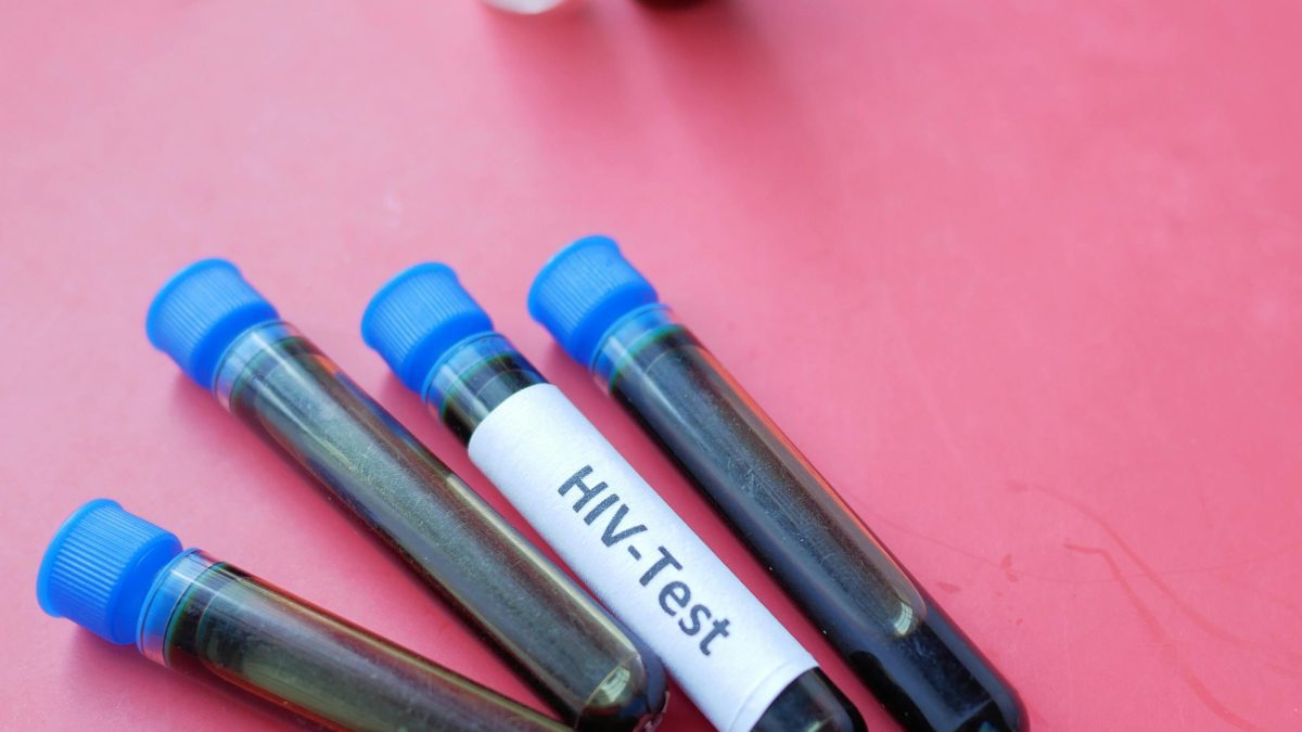 Very alarming statistics: Gen Z and Millennials lead in new HIV infections