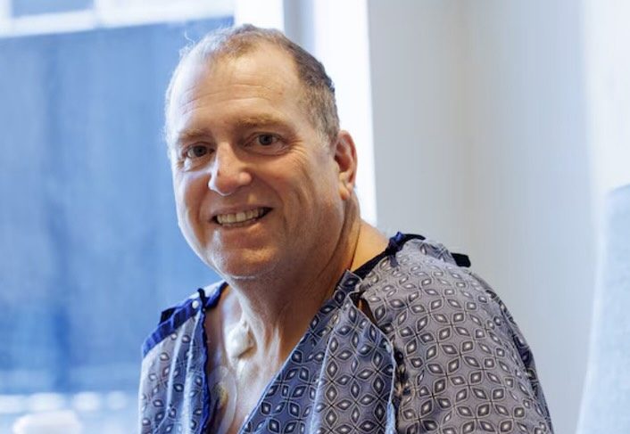 Man who received experimental pig kidney transplant now has a human organ