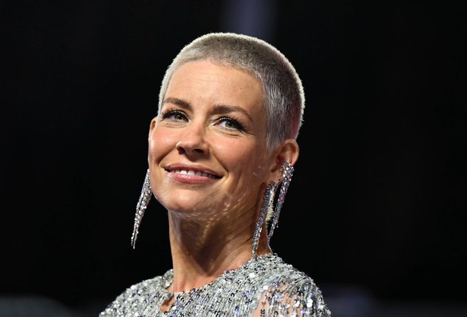 Marvel actor reveals she has brain damage after hitting her head in fall