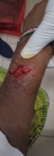 DJ Mo being attended to after surviving an attack by armed robbers. PHOTO/Screengrab by K24 Digital from https://www.instagram.com/size8reborn/