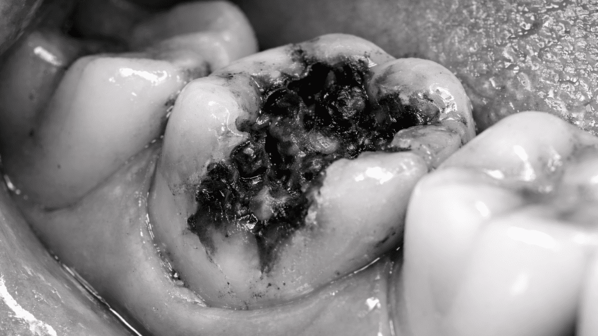 What happens when your bad tooth senses sugar in your mouth