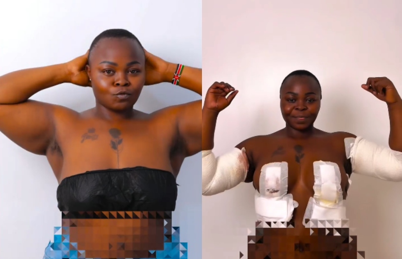 Pritty Vishy undergoes second round of cosmetic surgery for arms and breasts