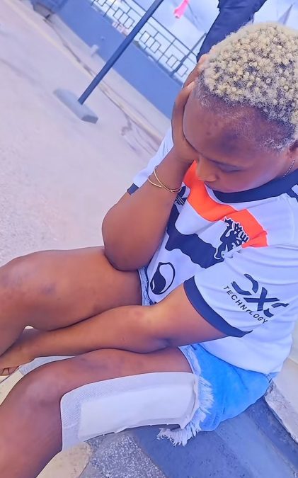 Shikie Kariuki posing for a photo days after the accident. PHOTOS/shikiewadjcapree/TikTok.