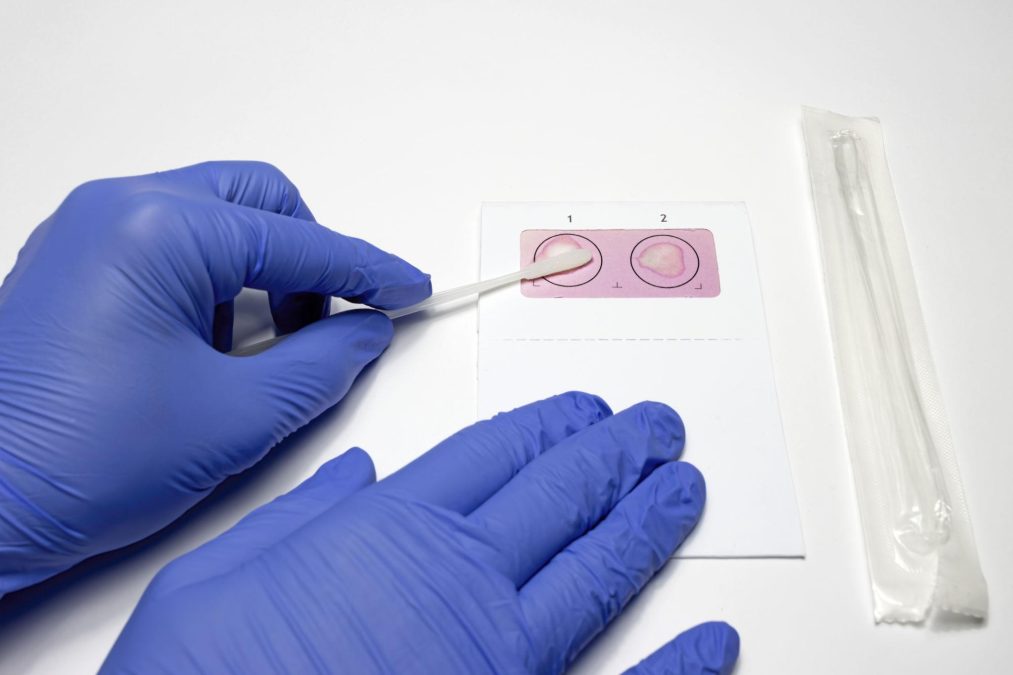 DNA sample