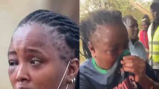 Ruiru TikToker who lost part of her lip after man dubbed ‘Vampire’ bit her narrates ordeal