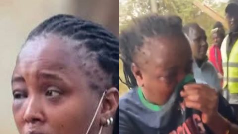 Ruiru TikToker who lost part of her lip after man dubbed ‘Vampire’ bit her narrates ordeal