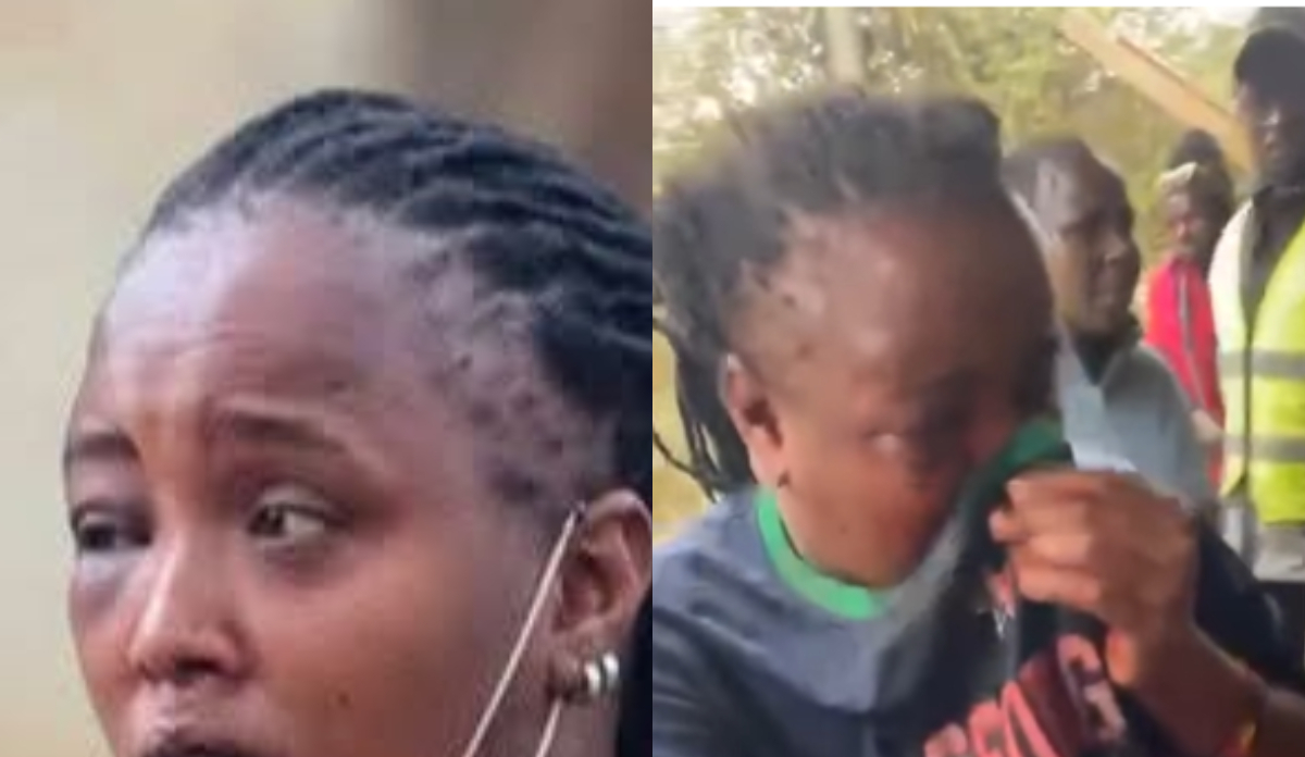 Ruiru TikToker who lost part of her lip after man dubbed 'Vampire' bit her narrates ordeal