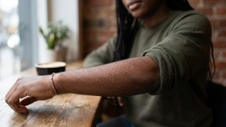 Why you get goosebumps when you’re cold or scared