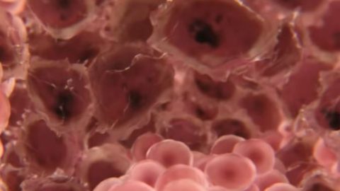 Research: Adults with severe mental illness die 15 to 20 years earlier from diseases such as cancer