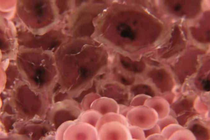 Research: Adults with severe mental illness die 15 to 20 years earlier from diseases such as cancer