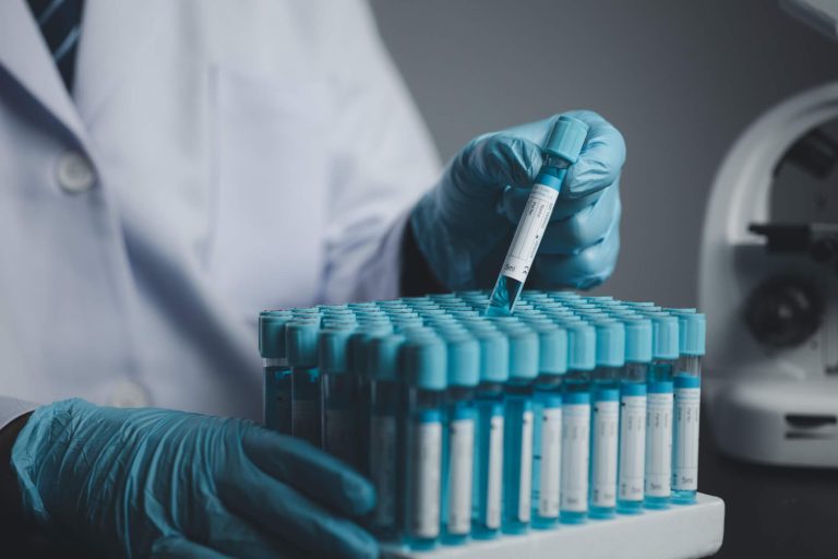Veterinary laboratory equipment used in animal disease surveillance.
