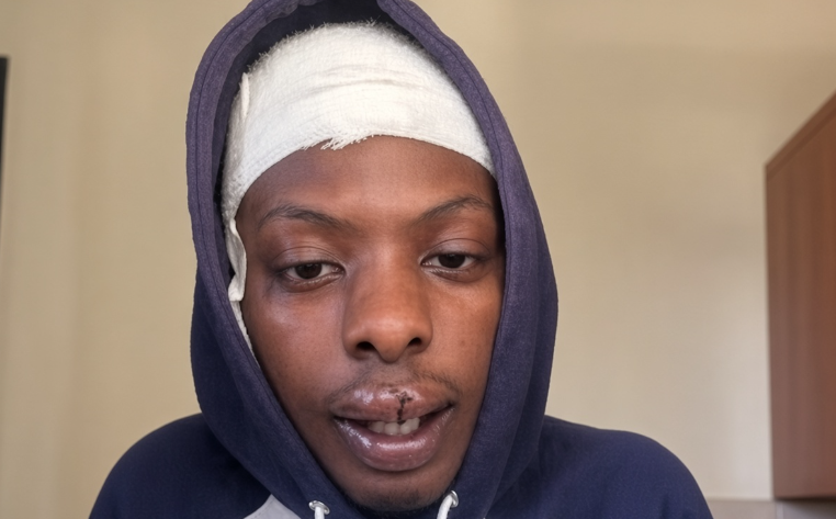 TikToker Victor Chege reveals traumatic encounter with thieves after Derrick Omollo’s death