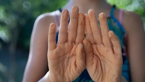 Why fingers wrinkle in water and what your body is doing about it